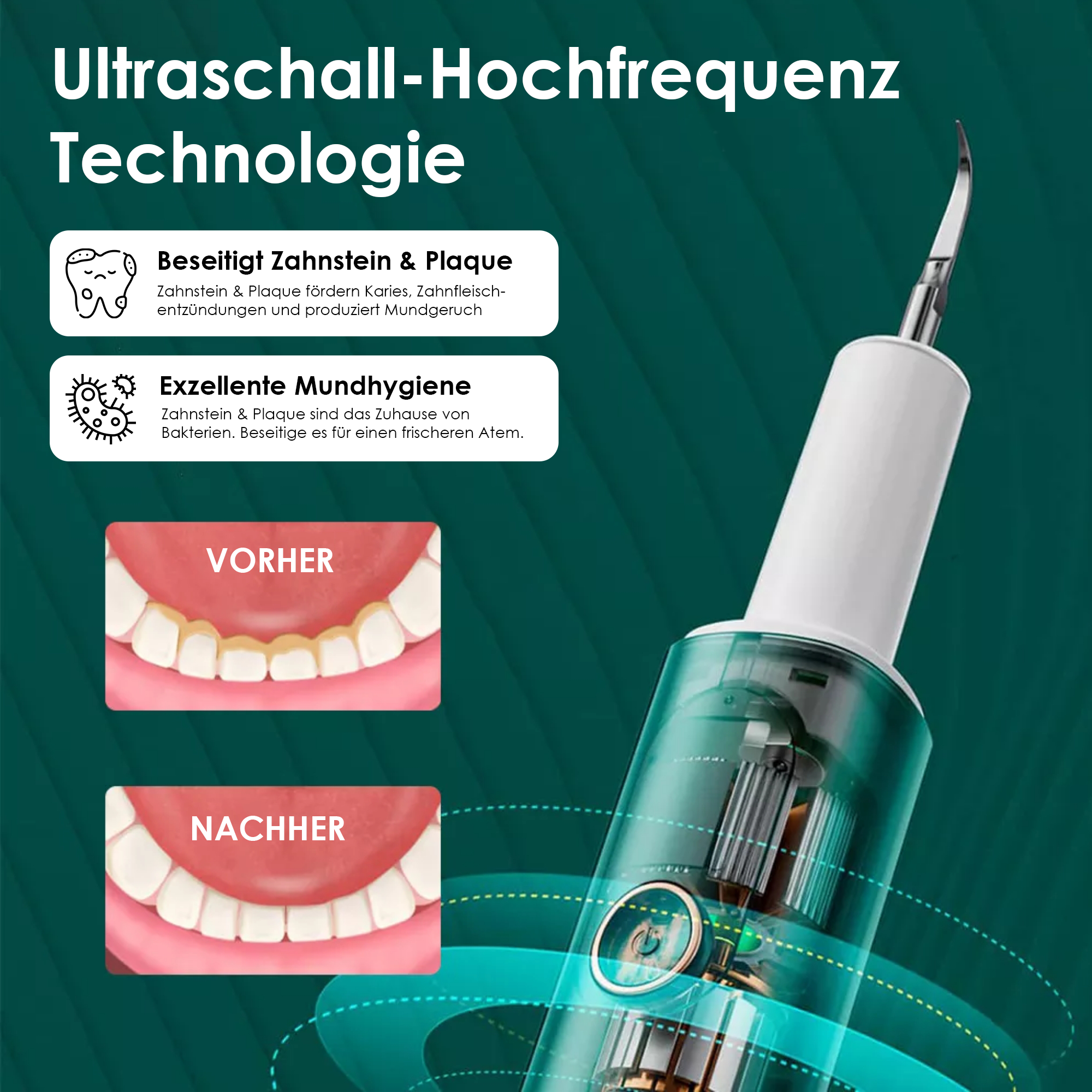 Ultraschall-Zahnsteinentferner mit einstellbaren Reinigungsstufen