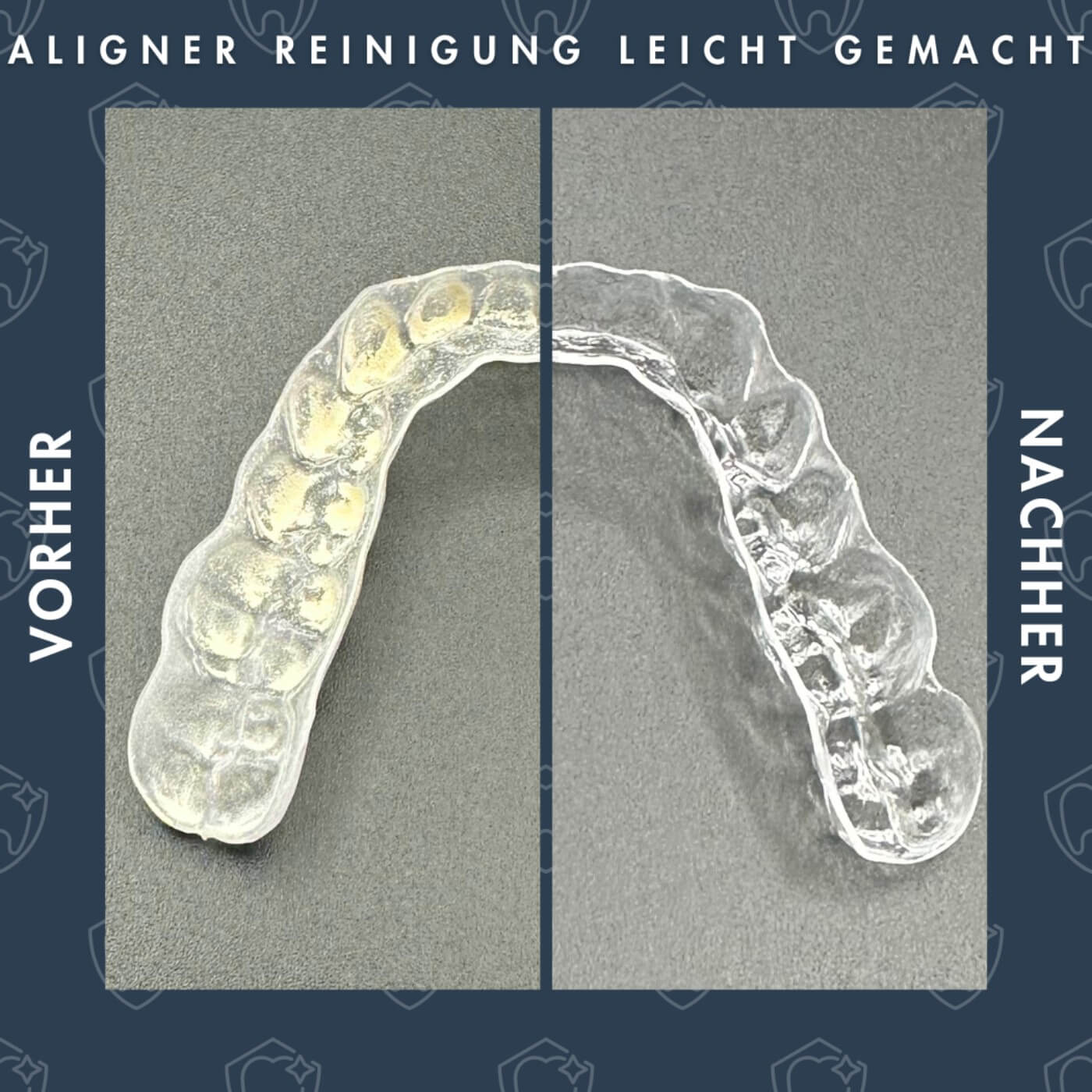 Ultrasonic Cleaner - Die Wirksamste Aligner-Reinigung